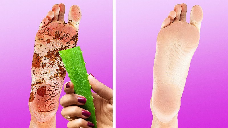 image 0 Aloe Vera Super Hacks To Add On Your Beauty Routines