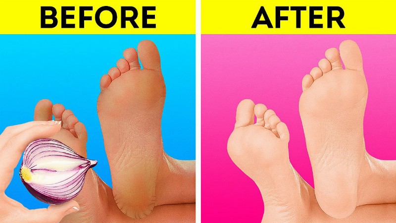 image 0 Wow! Genius Foot Care And Shoe Hacks For Your Comfort 🦶🏻👠
